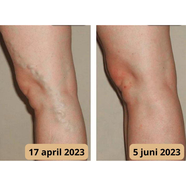 Fußmassagematte – AcupressureFlow