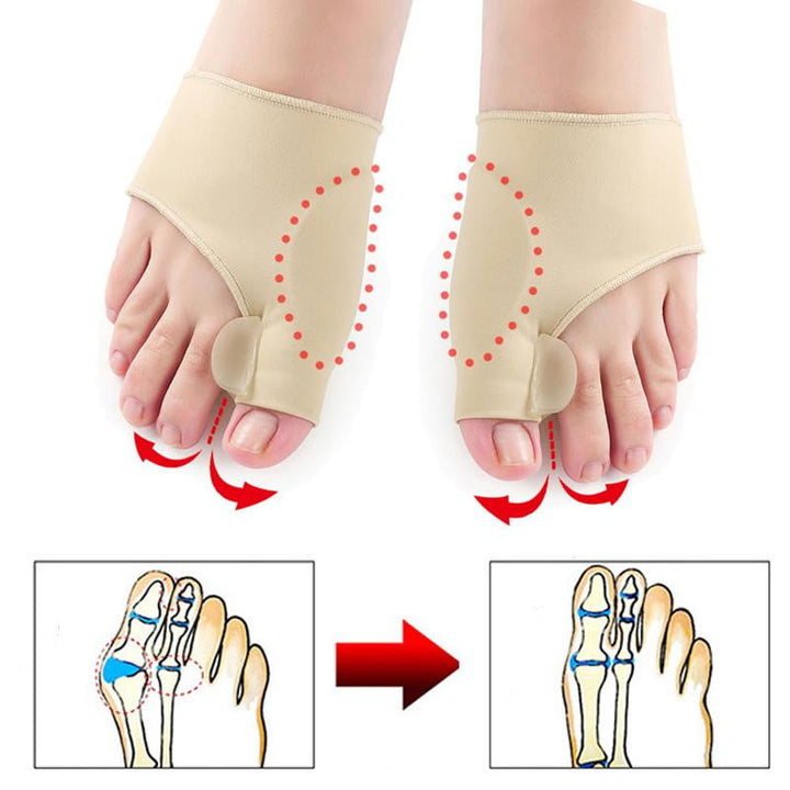 Hallux Valgus Protector (1 Pair) - OrthoBunion