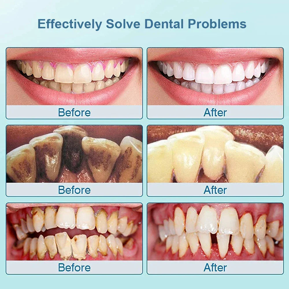 Ultrasonic Toothbrush - SonicClean
