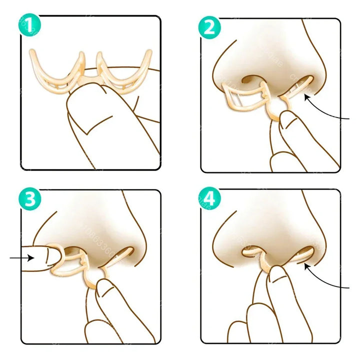 Comfortable Anti-Snoring Device – AirEase