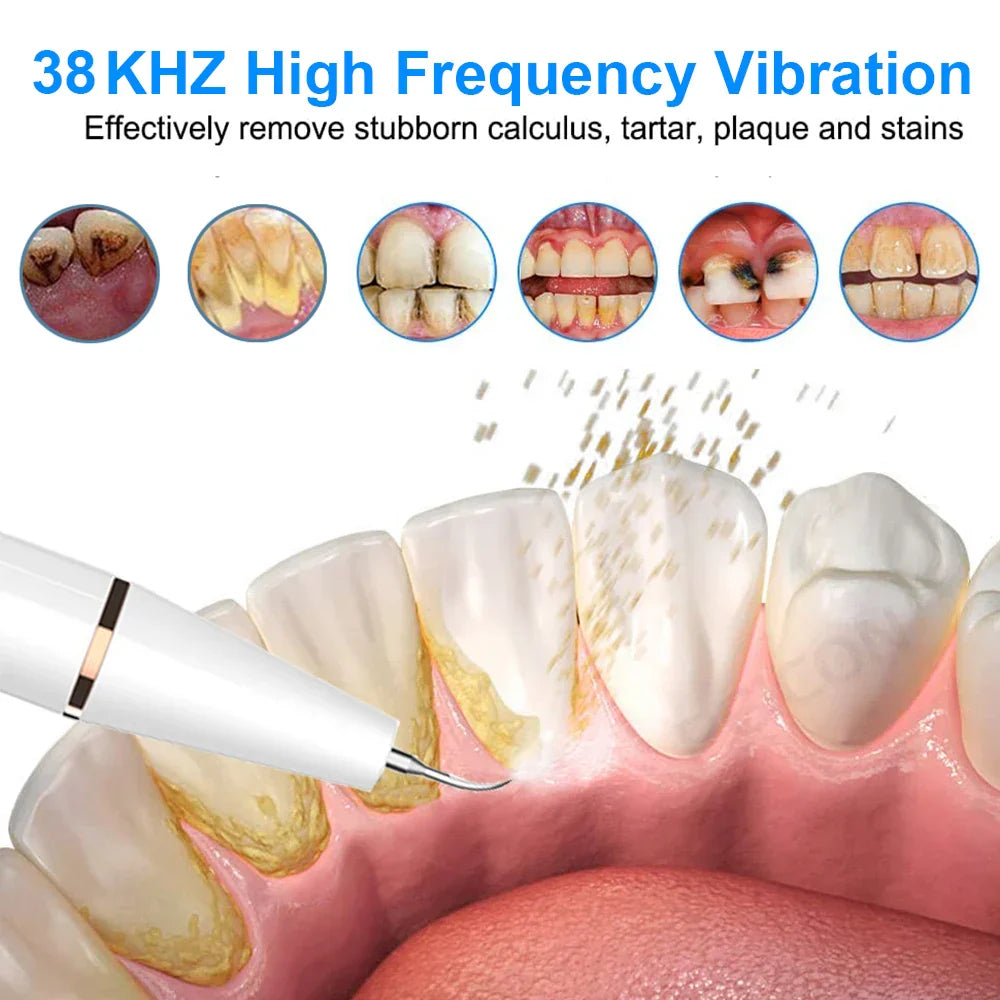 Ultrasonic Toothbrush - SonicClean