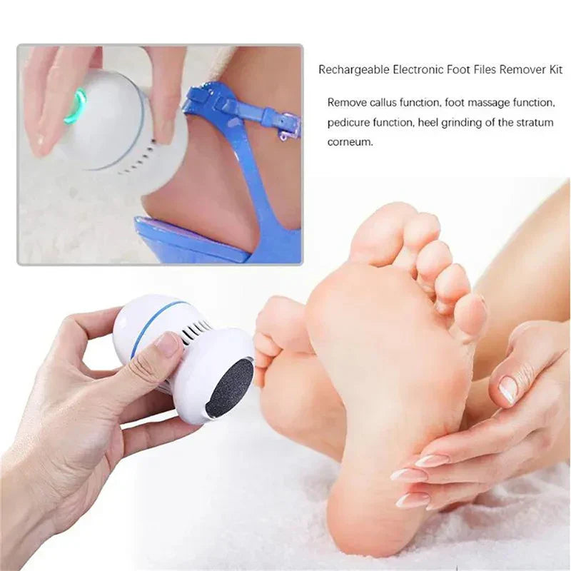 Professional Electric Callus Remover - SoleCare