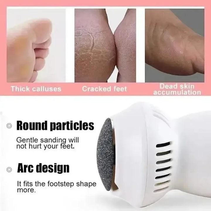 Professional Electric Callus Remover - SoleCare
