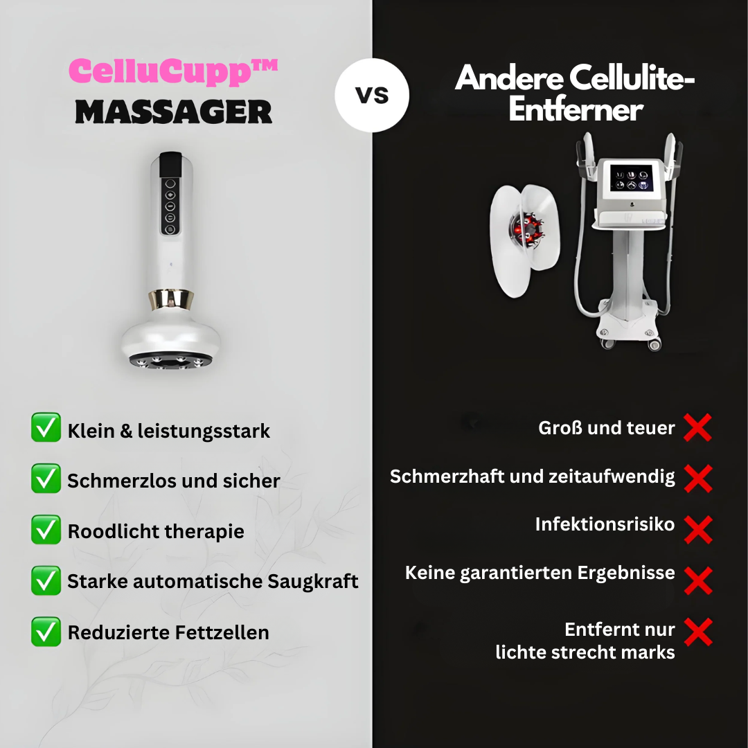 Anti-Cellulite-Cupping-Enhed – SlimCupp