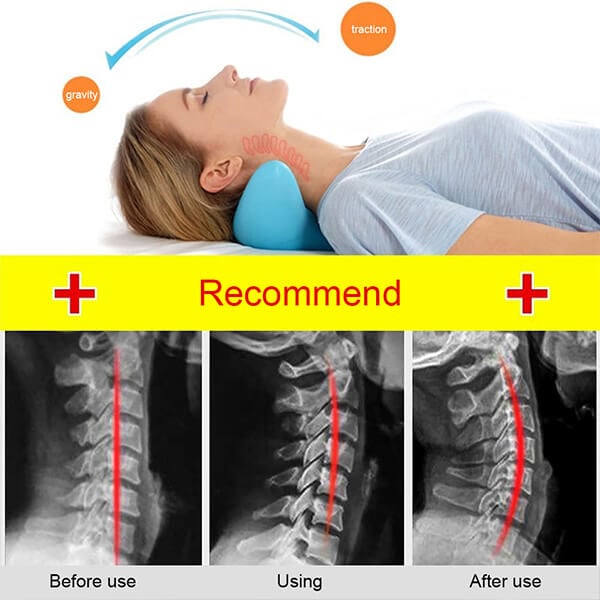 Ergonomic Neck Massage Pillow Without Electricity – NeckEase Stretch